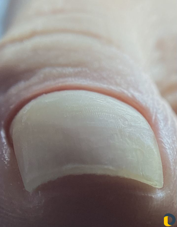 Эстетический педикюр