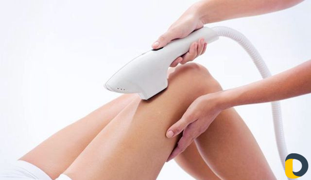 Фотоэпиляция на дому