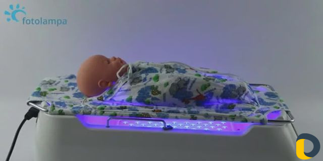Фотолампа для малышей от желтушки