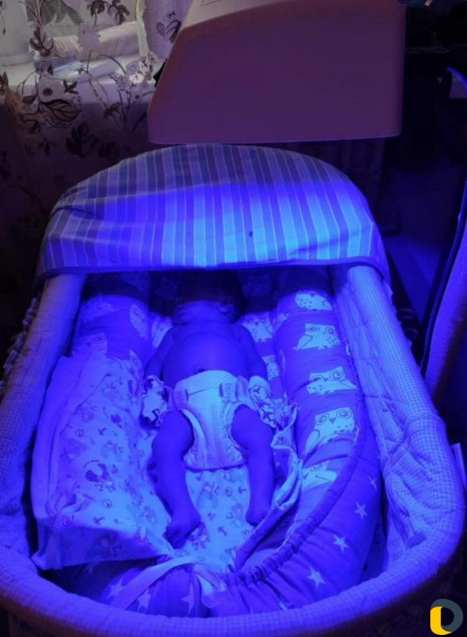 Фотолампа от желтухи в аренду +билитест