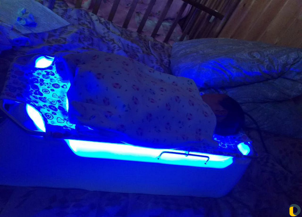 Фотолампа от желтухи в аренду +билитест