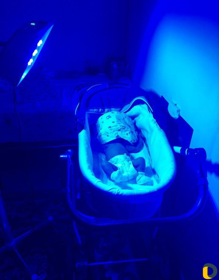 Фотолампа от желтухи в аренду +билитест