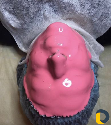 Капилляротерапия и Косметология