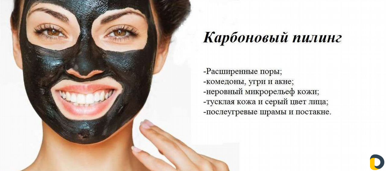 Карбоновый пилинг
