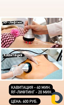 Кавитация