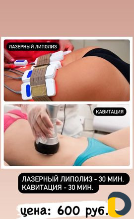 Кавитация
