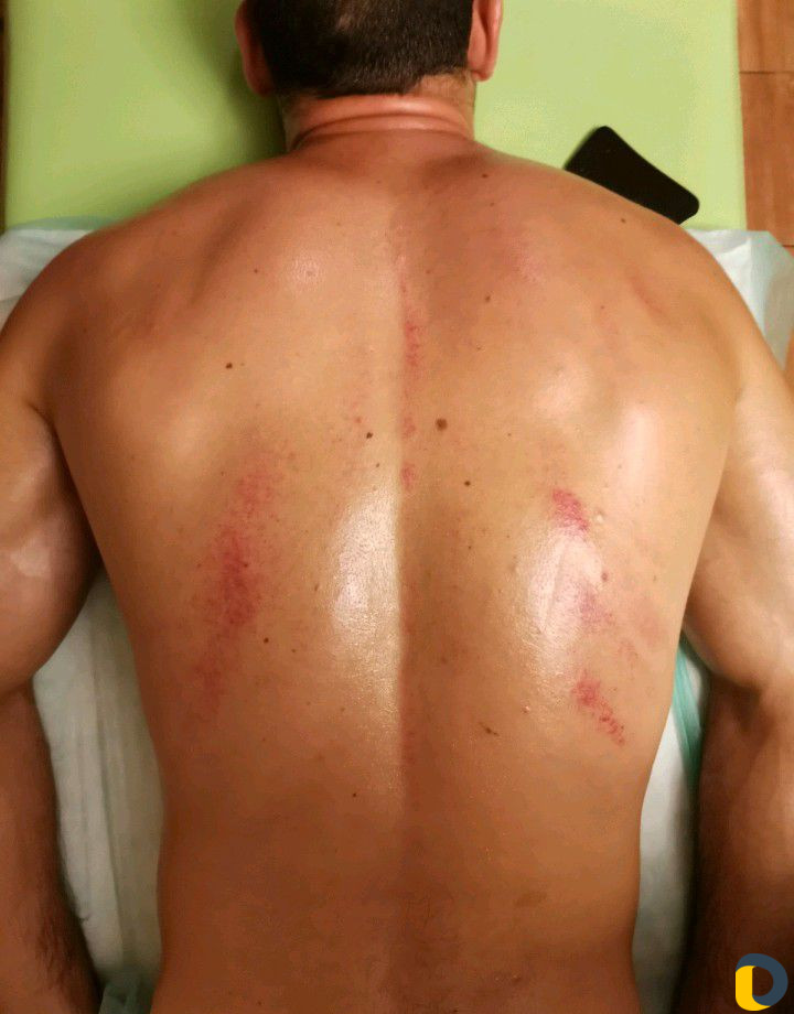 Китайский(Гуа-ша, баночный), спортивный, живота, л