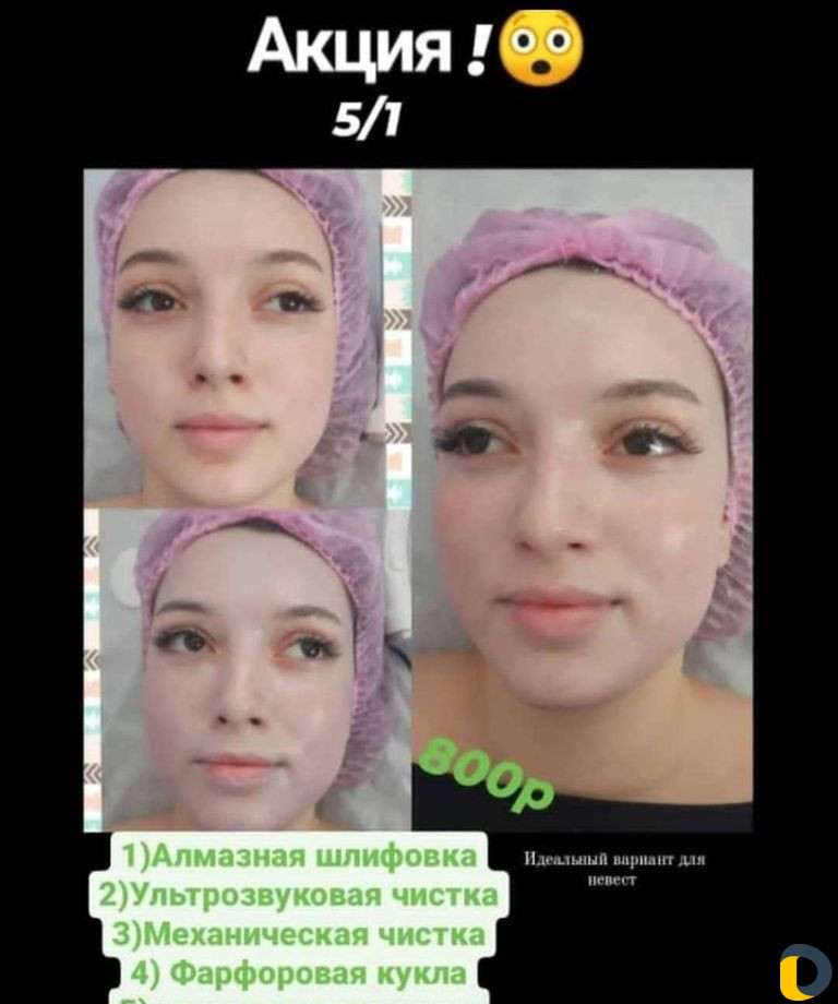 Комбинированная чистка лица