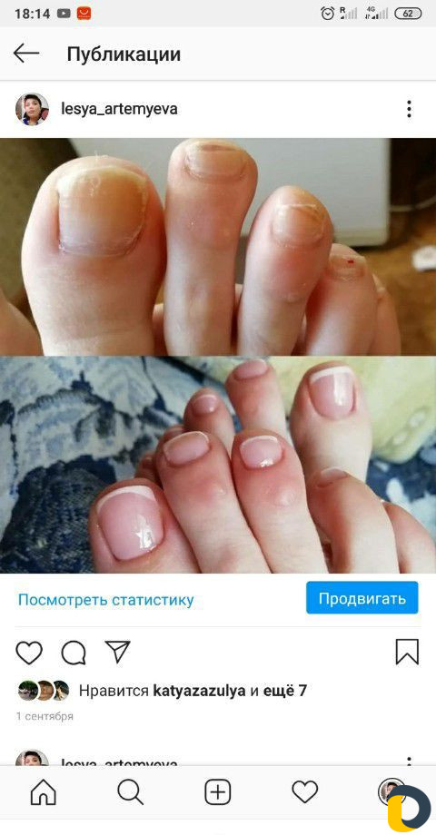 Комбинированный педикюр, маникюр