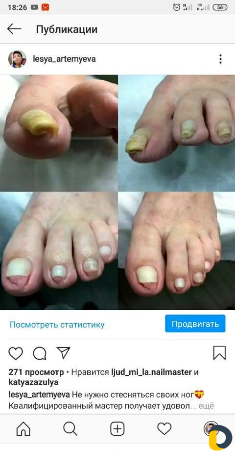Комбинированный педикюр, маникюр