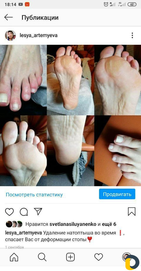 Комбинированный педикюр, маникюр