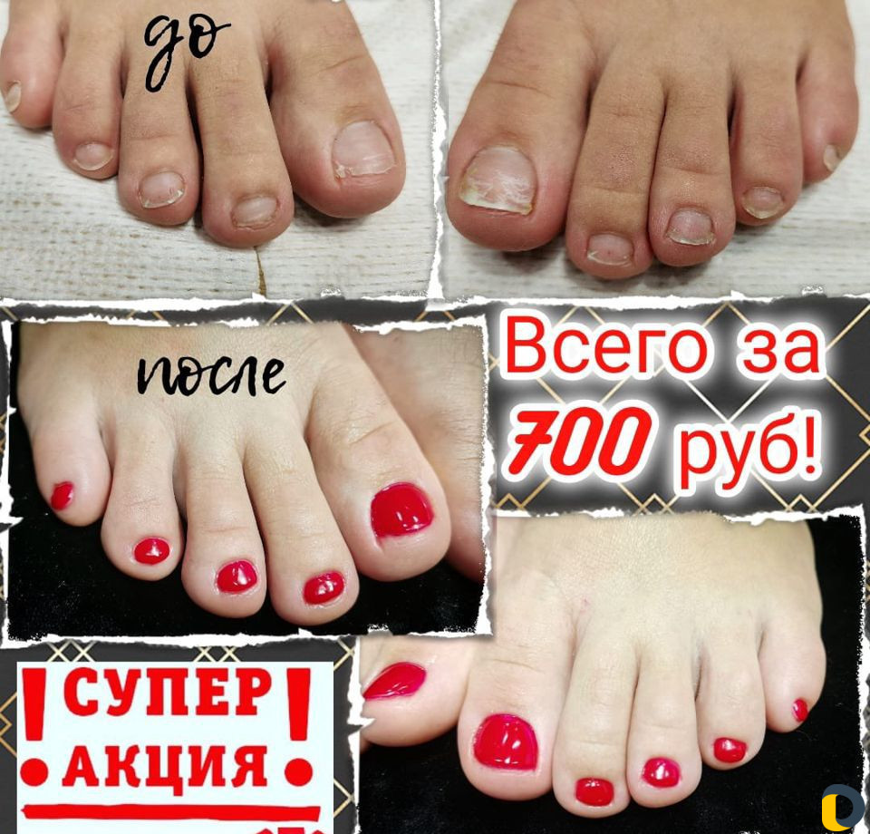 Коррекция ногтей,маникюр,педикюр