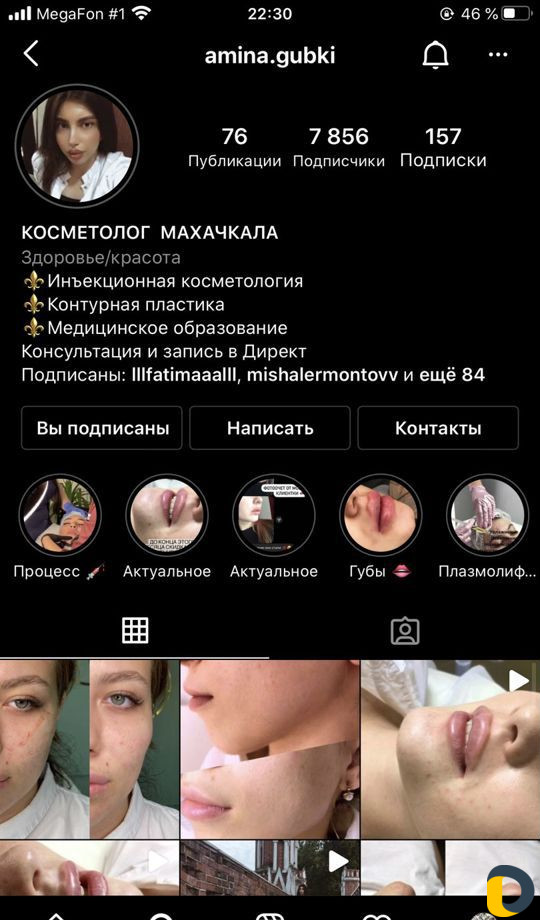 Косметолог чистка лица