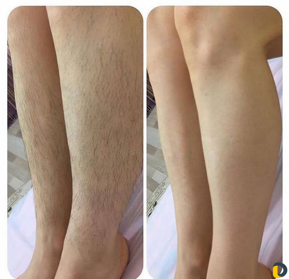 Косметолог чистка лица