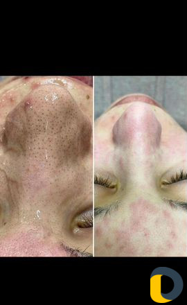 Косметолог эстет