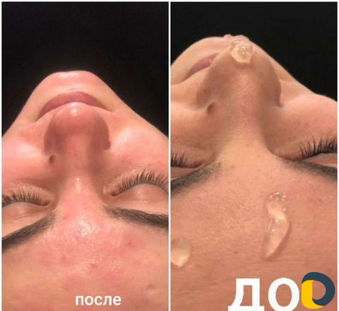 Косметолог эстет