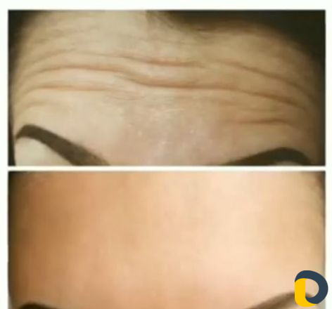 Косметолог эстетист инъекционист