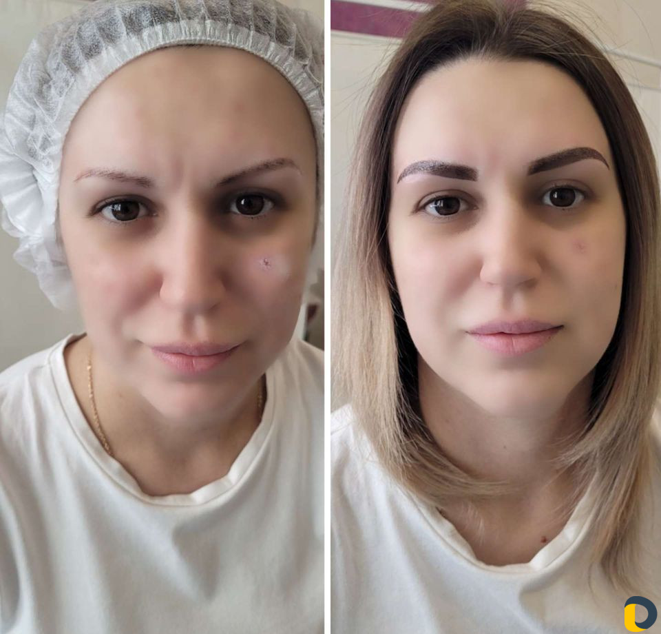 Косметолог,губы,чистка,брови,прокол ушей,депиляция