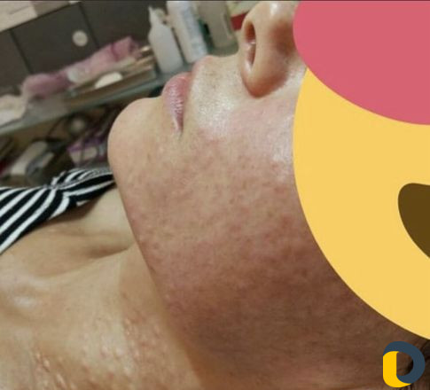 Косметологические процедуры