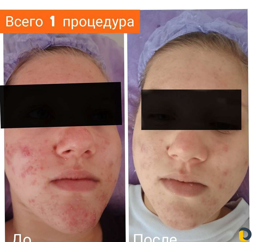 Косметология, массаж