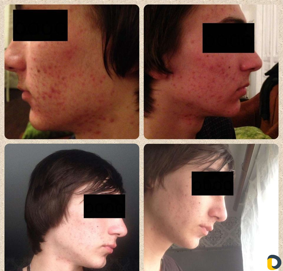 Косметология, массаж