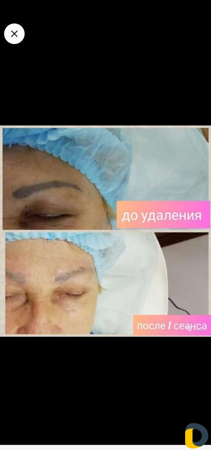 Косметология, массаж