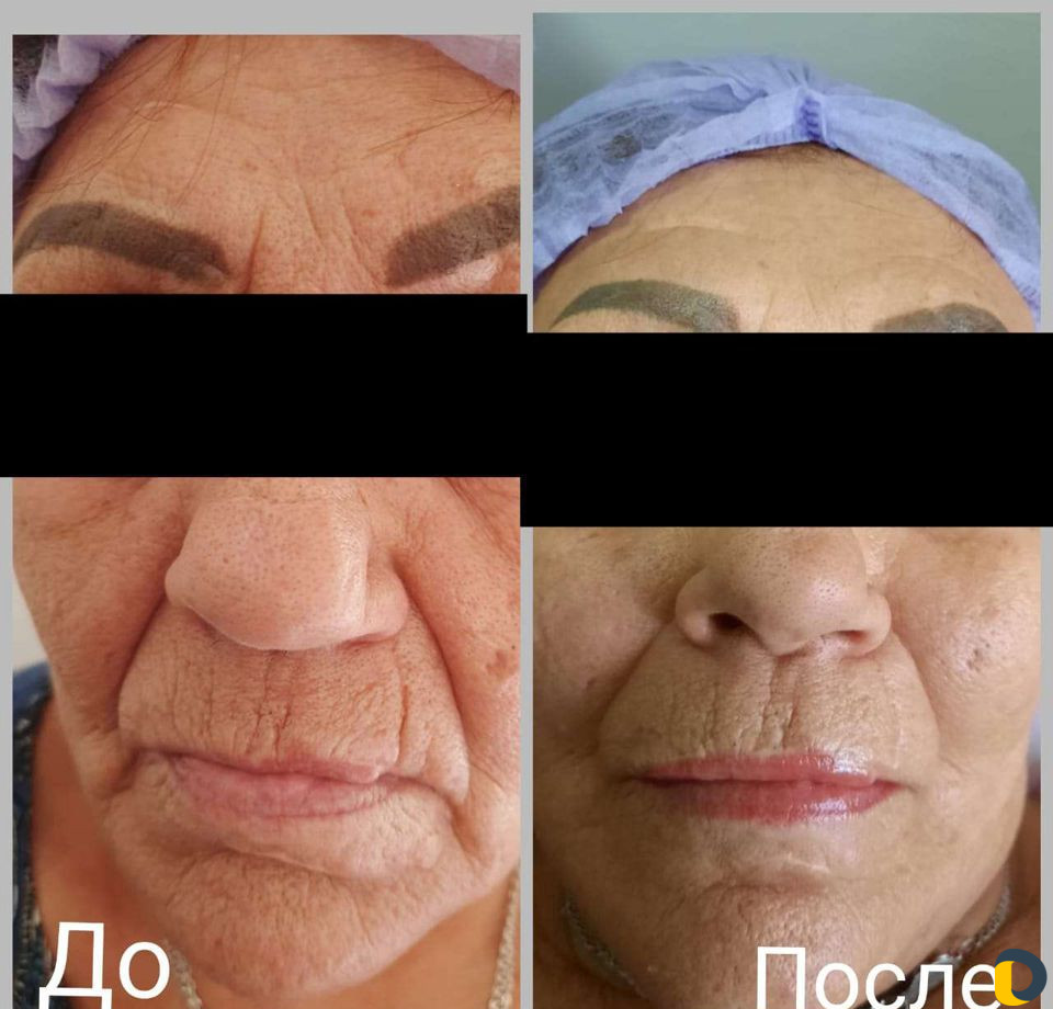 Косметология, массаж