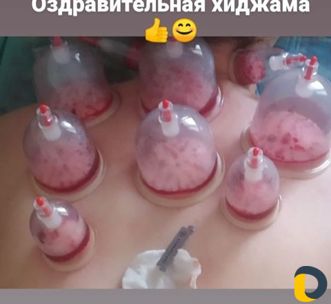 Ламинирование ресниц и бровей