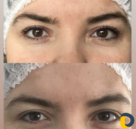 Ламинирование ресниц