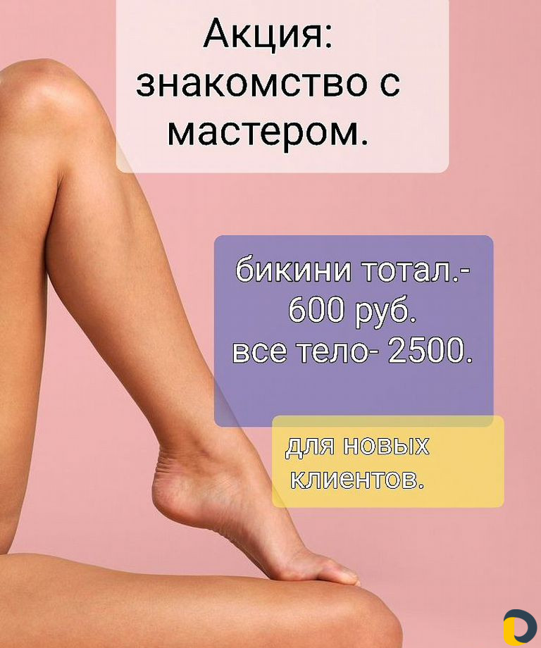 Лазерная эпиляция