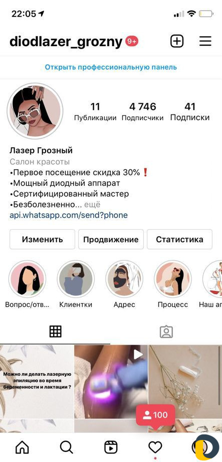 Лазерная эпиляция