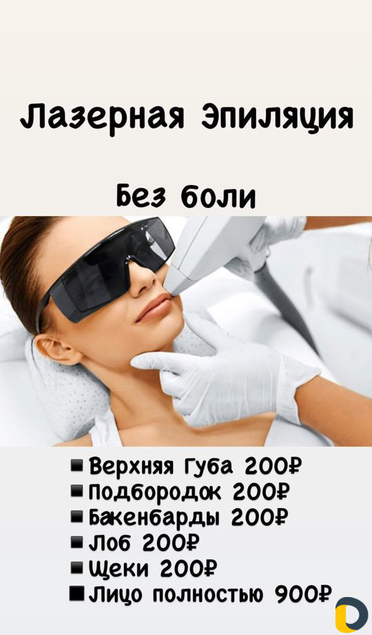 Лазерная эпиляция