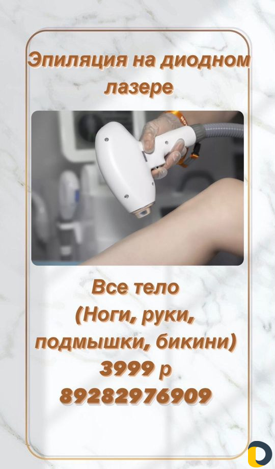 Лазерная эпиляция