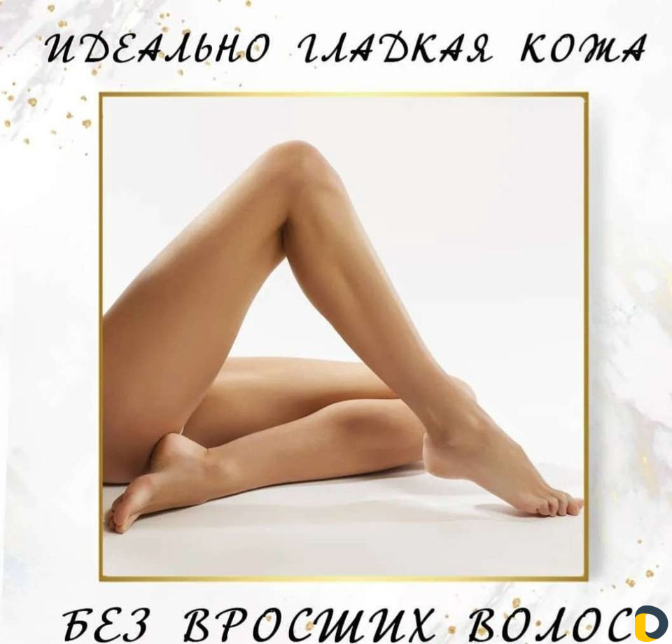 Лазерная эпиляция