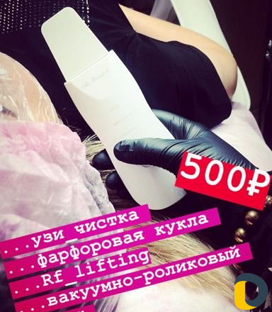 Лазерная эпиляция