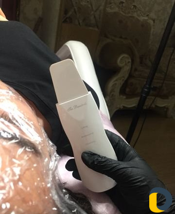 Лазерная эпиляция