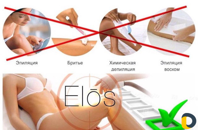 Лазерная Эпиляция