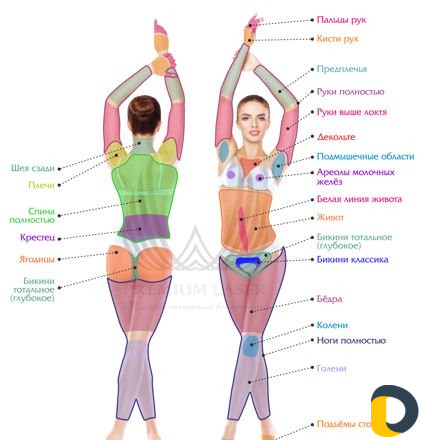 Лазерная эпиляция