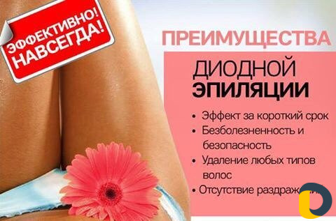 Лазерная эпиляция