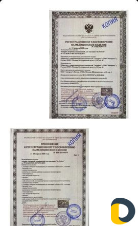 Лазерная эпиляция