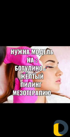 Лазерная эпиляция