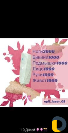 Лазерная эпиляция