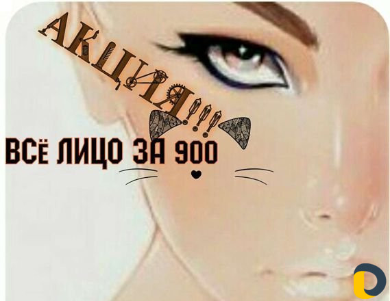 Лазерное эпиляция