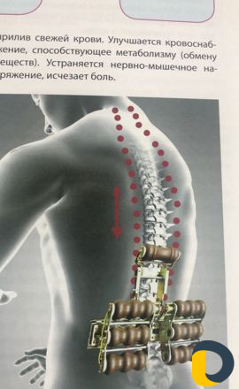 Лечение спины