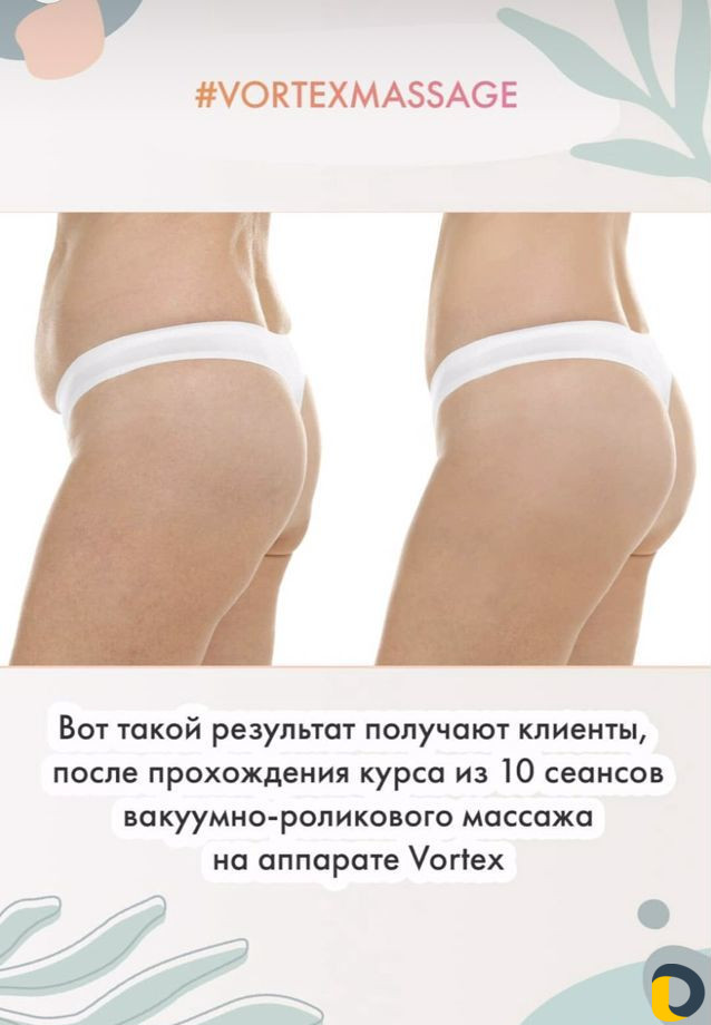 Lpg массаж