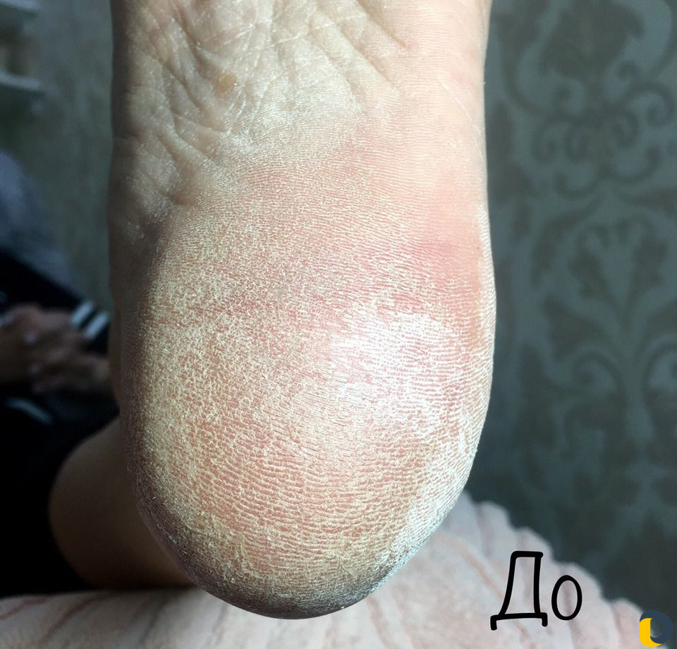 Маникюр и педикюр