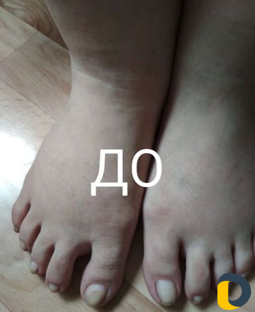 Маникюр и педикюр