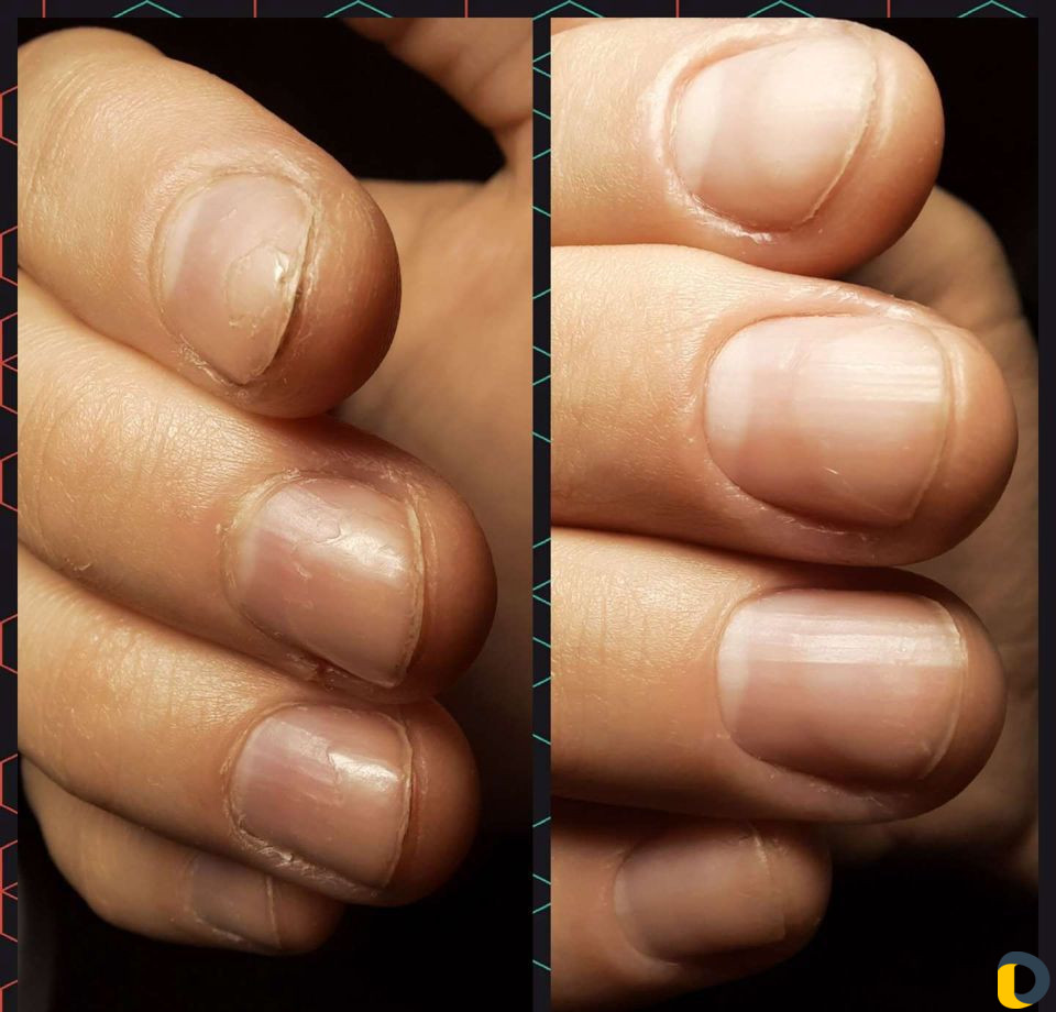 Маникюр и педикюр