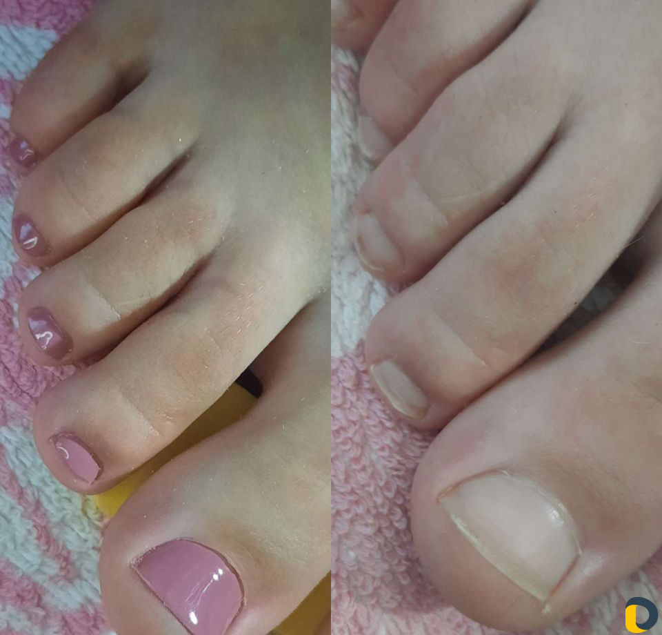 Маникюр,наращивание ногтей,коррекция, педикюр