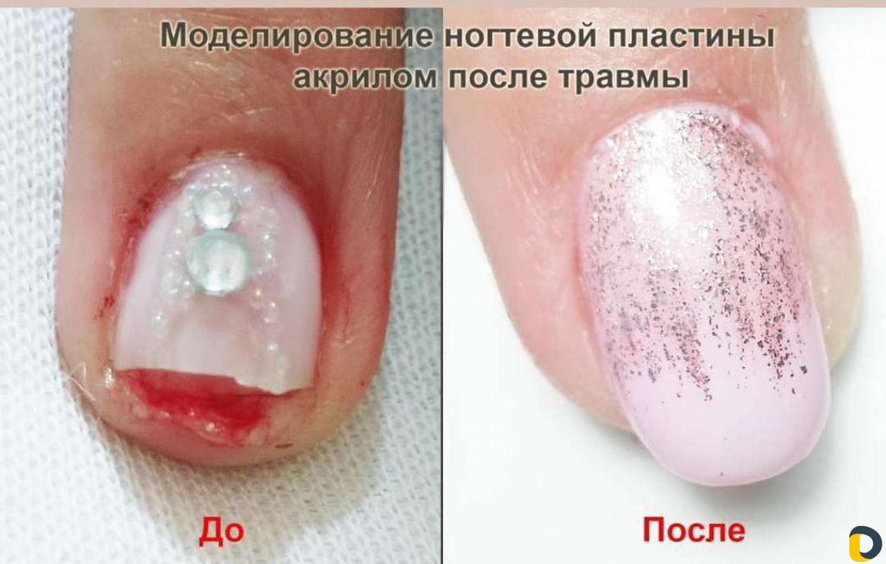 Маникюр, педикюр, наращивание ногтей